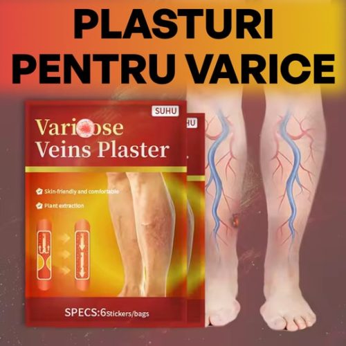 Reparación de venas verbales venas